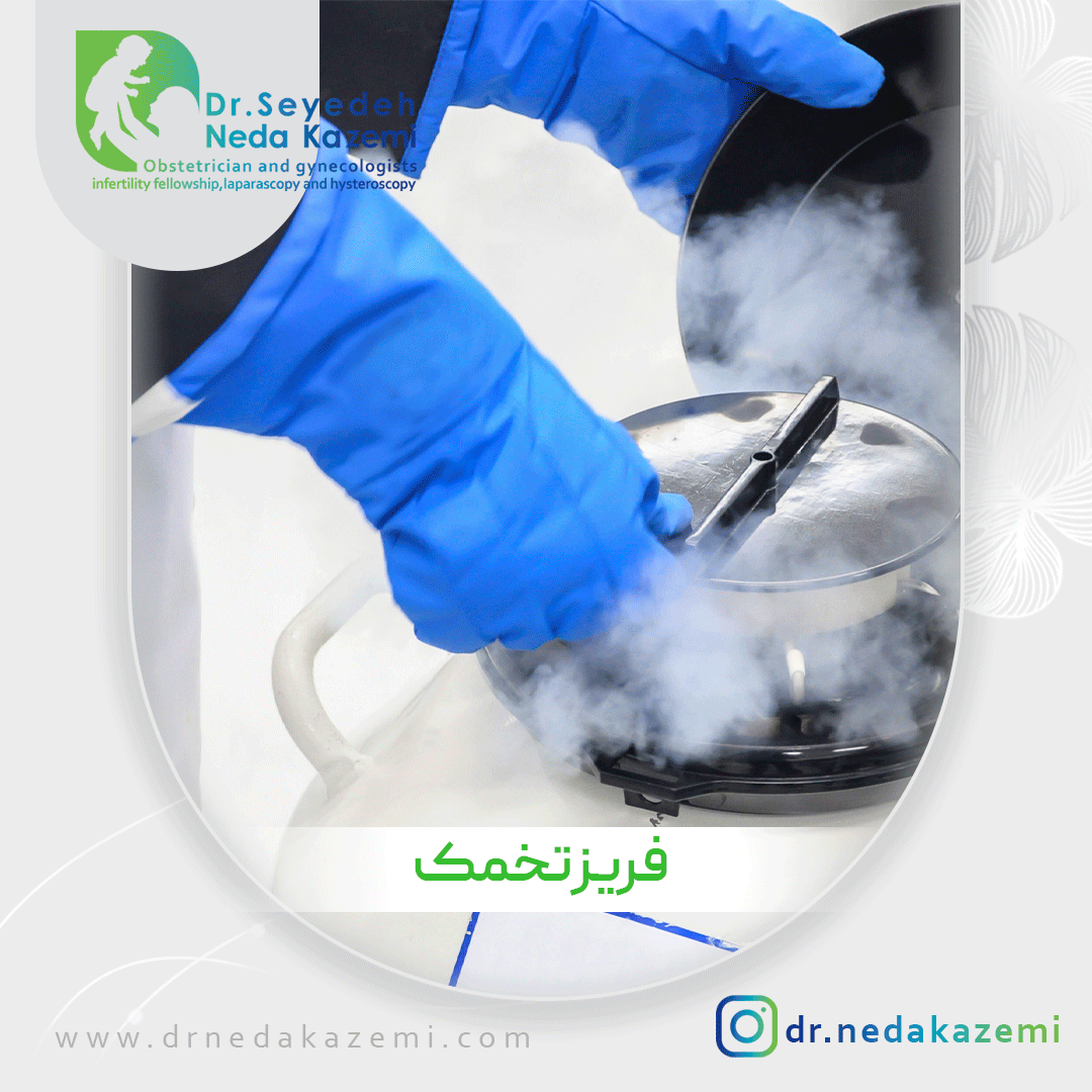 فریز تخمک