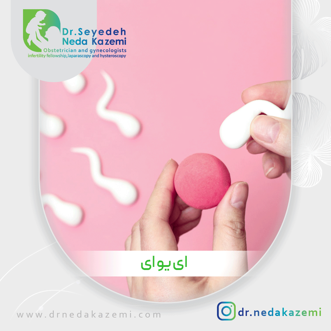 ای یو ای